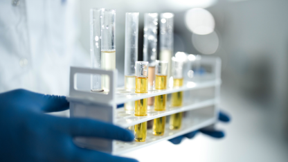 En forskare med handskar på händerna bär en bricka med provrör. 